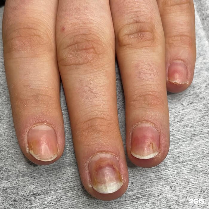 коричневые ногти после гель лака