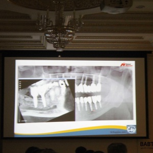 Фото от владельца БАБТА, центр стоматологии и имплантации