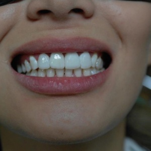 Фото от владельца Natural Dent, стоматология